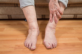 geriatric foot care