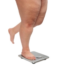 How the Feet Are Affected by Childhood Obesity