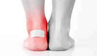 Effective Methods in Foot Blister Prevention